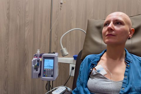 Chemotherapy